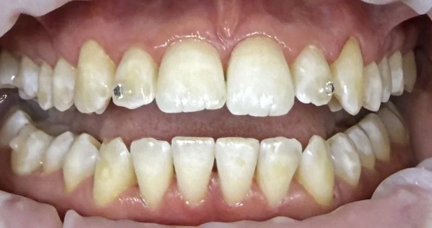 Po ošetrení - testovacia fotografia 1