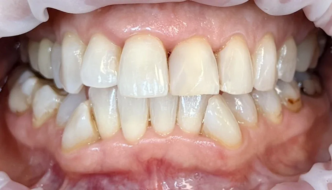 Po ošetrení - testovacia fotografia 2