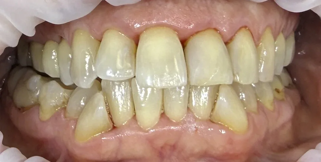 Pred ošetrením - testovacia fotografia 2